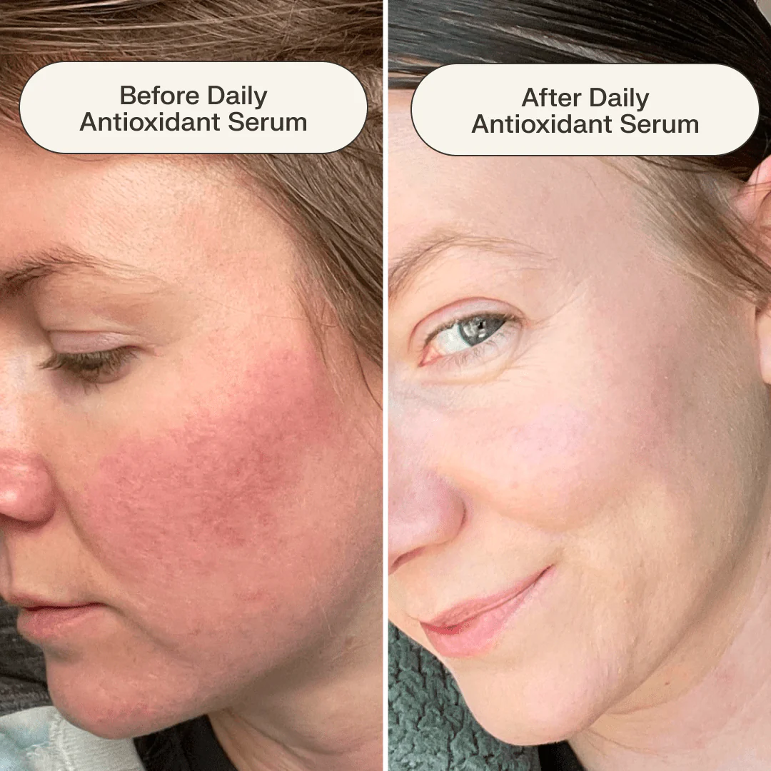 Daily Antioxidant Serum - Image 5